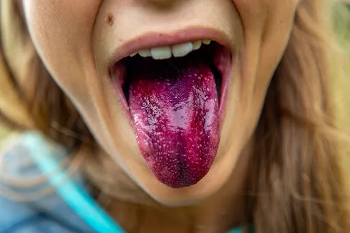 Close-up of an open mouth with the tongue extended, showing its surface and position